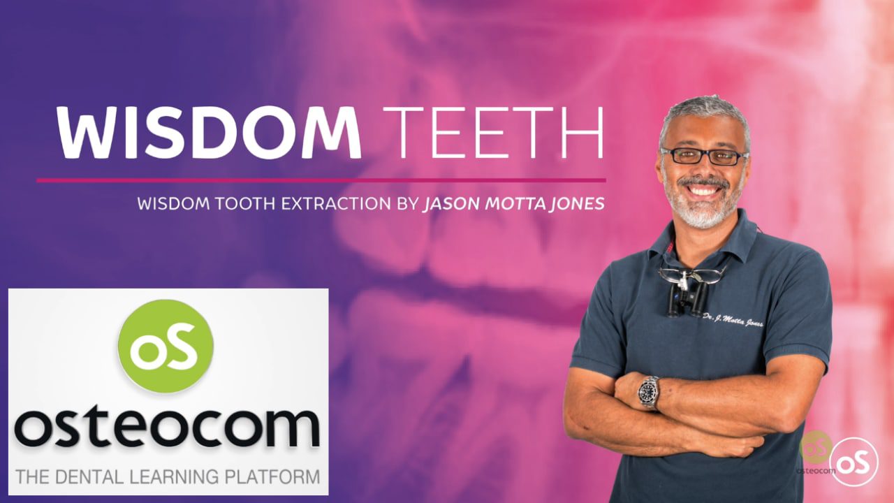 Osteocom Wisdom Tooth Extraction Jason Motta Jones Osteocom Wisdom Tooth Extraction Jason Motta Jones