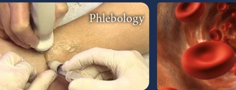 Pegasus Fundamentals Of Phlebology Ultrasound And Venous Insufficiency 2022 Pegasus Fundamentals Of Phlebology Ultrasound And Venous Insufficiency 2022