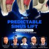 Predictable Sinus Lift Course Predictable Sinus Lift Course