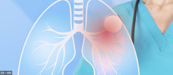 Respiratory / Pulmonary