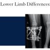 Managing Children with Lower Limb Differences: An Integrated Approach 2022 UCSF Managing Children with Lower Limb Differences An Integrated Approach 2022