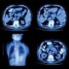 NYU Langone’s Head to Toe Imaging 2022 UCSF Radiology Clinical Update 2023