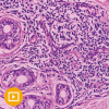 Dermatopathology 2023 capture 3