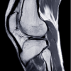 UCSF Neuro and Musculoskeletal Imaging 2022 capture 3 2