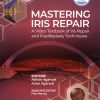 Mastering Iris Repair: A Video Textbook of Iris Repair and Pupilloplasty Techniques (PDF Book) mastering iris repair
