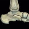 MRI Online MRI Mastery Series: Ankle 2017 mri mastery series ankle 510x463 1