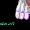 Ninja Sinus Lift Course ninja sinus lift 510x250 1