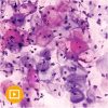 Oakstone Gynecologic Pathology 2022 oakstone gynecologic pathology 2022