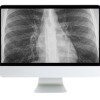 ARRS Case-Based Imaging Review Online Course 2022 oc case review 510x446 1
