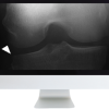 Musculoskeletal Imaging for the Practicing Radiologist 2018 (ARRS VIDEOS) oc mk18 510x444 1