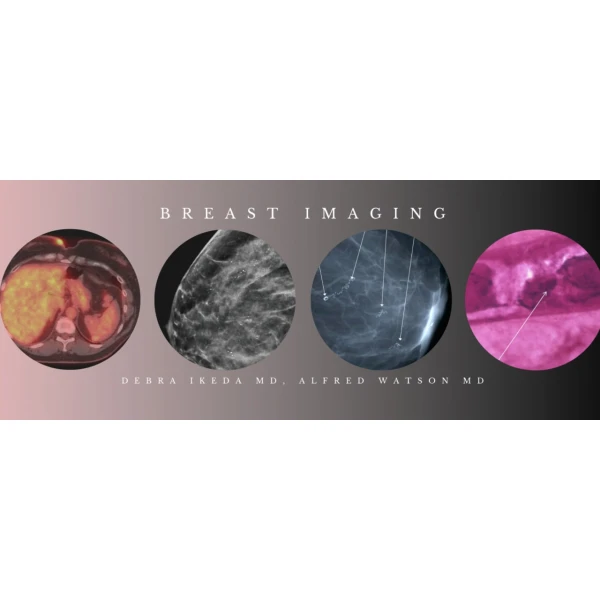 CME Science Breast Imaging BUNDLE (Programs 1-3) Debra Ikeda MD, Alfred Watson MD 2020