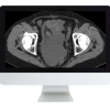Radiologic Reasoning: A Rapid-Fire Multispecialty Review 2018 (ARRS VIDEOS) radiologic review lr 510x446 1