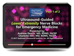 ultrasound guided lower extremity nerve blocks