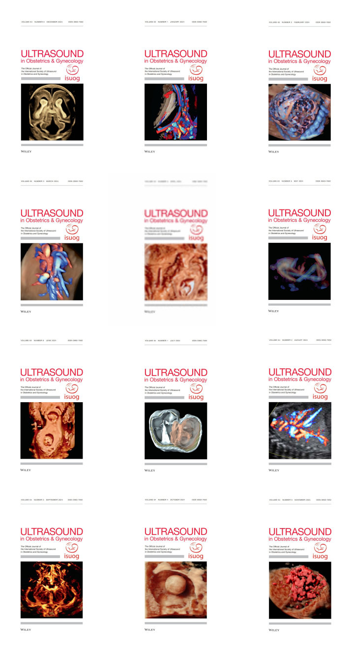 Ultrasound in Obstetrics & Gynecology 2024 Full Archives (True PDF) Ultrasound in Obstetrics & Gynecology 2024 Full Archives (True PDF)