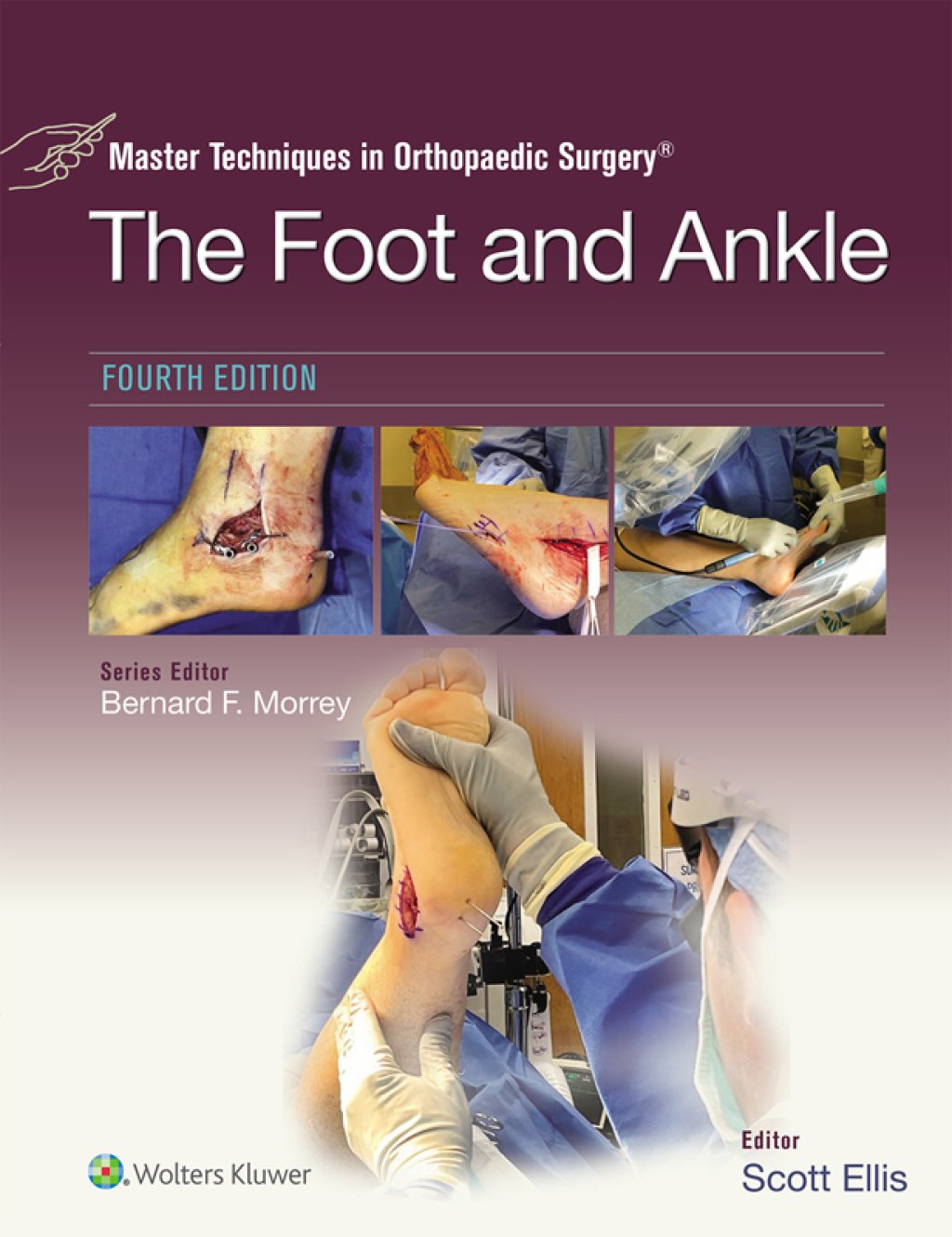 Master Techniques in Orthopaedic Surgery: The Foot and Ankle, 4th Edition (EPUB + Videos) Master Techniques in Orthopaedic Surgery: The Foot and Ankle, 4th Edition (EPUB + Videos)