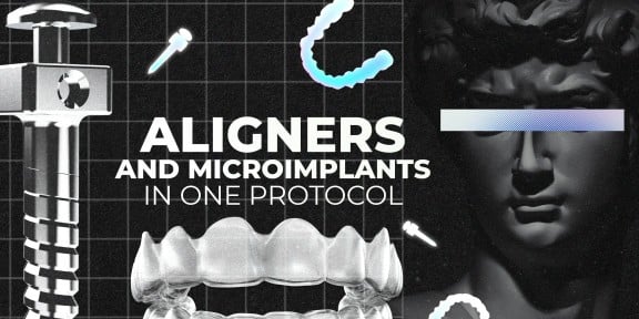 OHI-S Aligners And Microimplants In One Protocol OHI-S Aligners And Microimplants In One Protocol