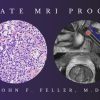 2021 Prostate MRI (Program 1) – John F. Feller, M.D(vedio) 2021 Prostate MRI (Program 1) – John F. Feller, M.D