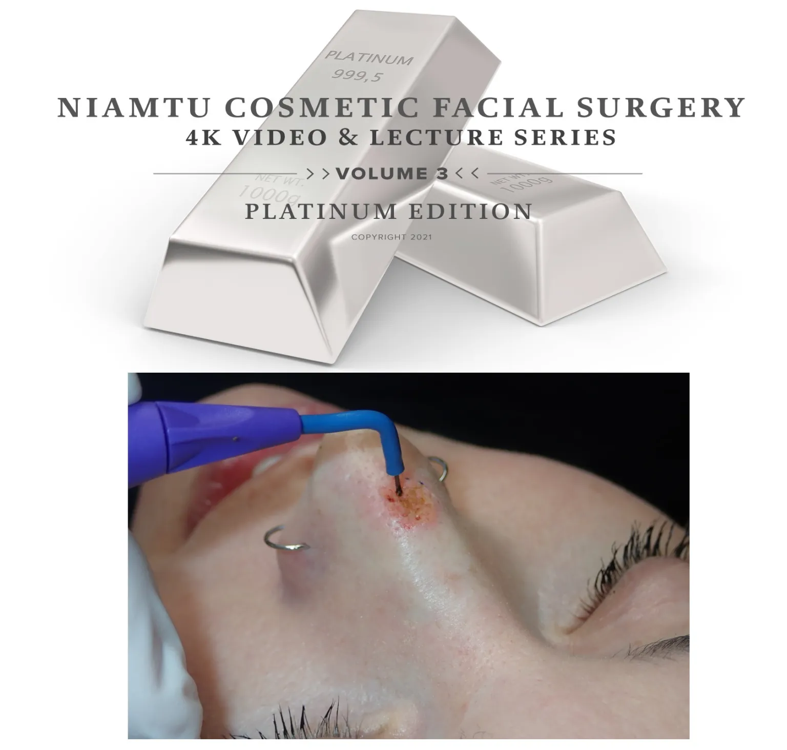 Head & Neck Radiowave Mole and Lesion Removal Head & Neck Radiowave Mole and Lesion Removal