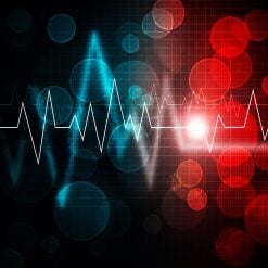 Mayo Clinic Practical ECG Pearls – ECG Rhythm Update 2020