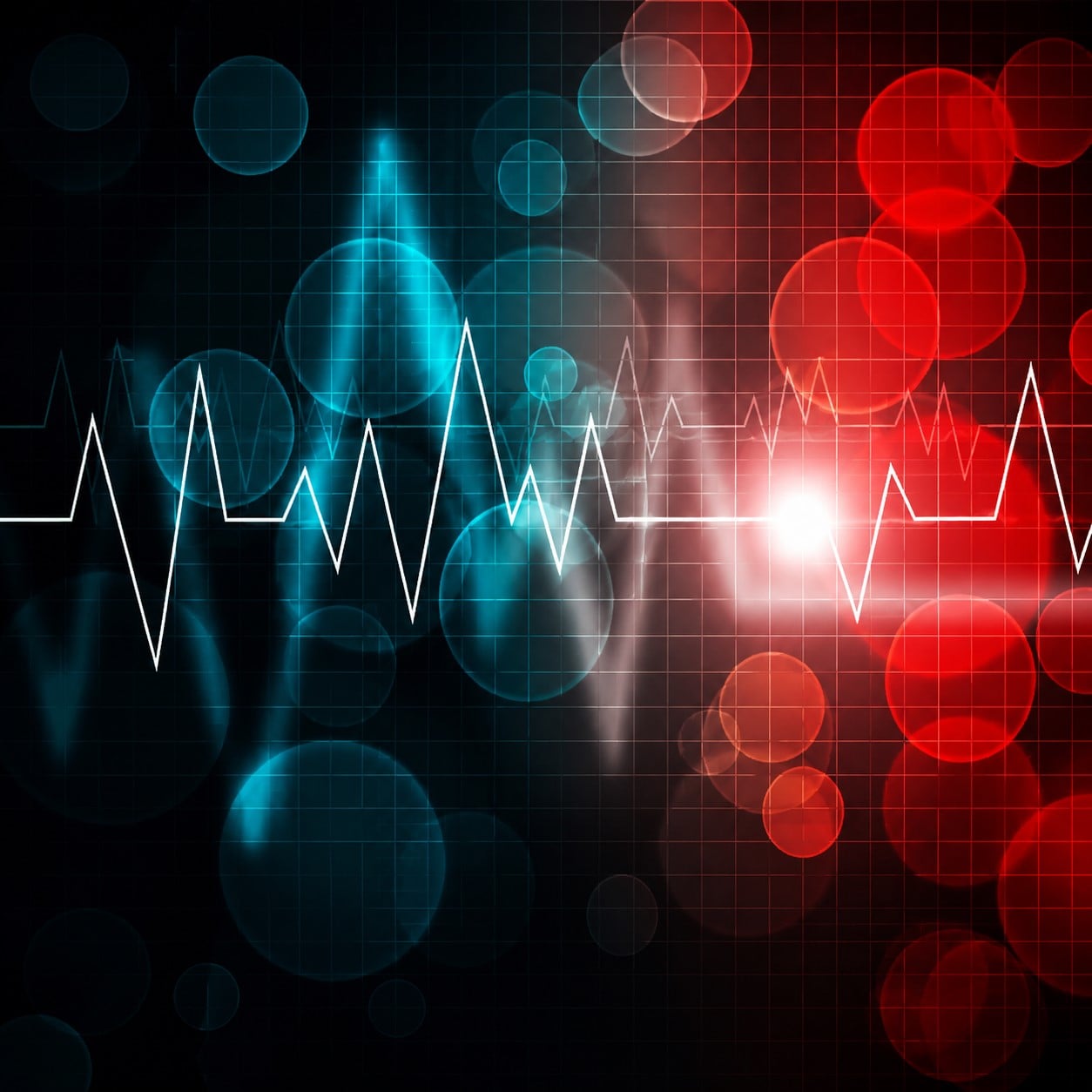 Mayo Clinic Practical ECG Pearls – ECG Rhythm Update 2020 Mayo Clinic Practical ECG Pearls – ECG Rhythm Update 2020