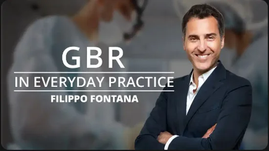 Osteocom GBR in Everyday Practice Osteocom GBR in Everyday Practice