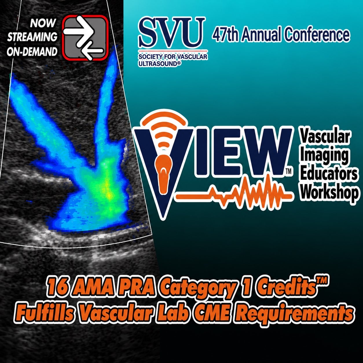 Vascular Imaging Educators Workshop (VIEW) 2025 (Videos) Vascular Imaging Educators Workshop (VIEW) 2025 (Videos)