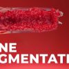 OHI-S Bone Augmentation Current Techniques OHI-S Bone Augmentation Current Techniques