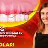 OHI-S Non-Surgical Periodontal Therapy and Minimally Invasive Protocols OHI-S Non-Surgical Periodontal Therapy and Minimally Invasive Protocols