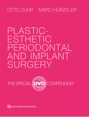 Plastic-Esthetic Periodontal and Implant Surgery The Special DVD Compendium Plastic-Esthetic Periodontal and Implant Surgery The Special DVD Compendium