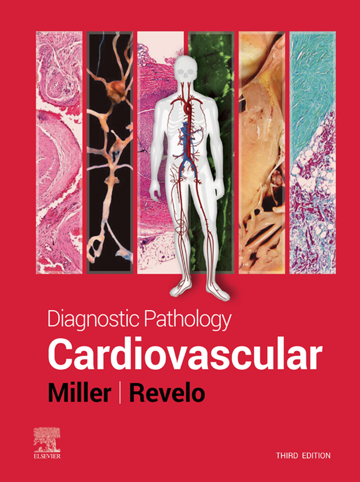 Diagnostic Pathology: Cardiovascular, 3rd Edition (EPUB) Diagnostic Pathology: Cardiovascular, 3rd Edition (EPUB)