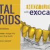 Digital Hybrids for Dentists & Technicians Digital Hybrids for Dentists & Technicians