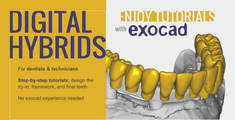 Digital Hybrids for Dentists & Technicians Digital Hybrids for Dentists & Technicians