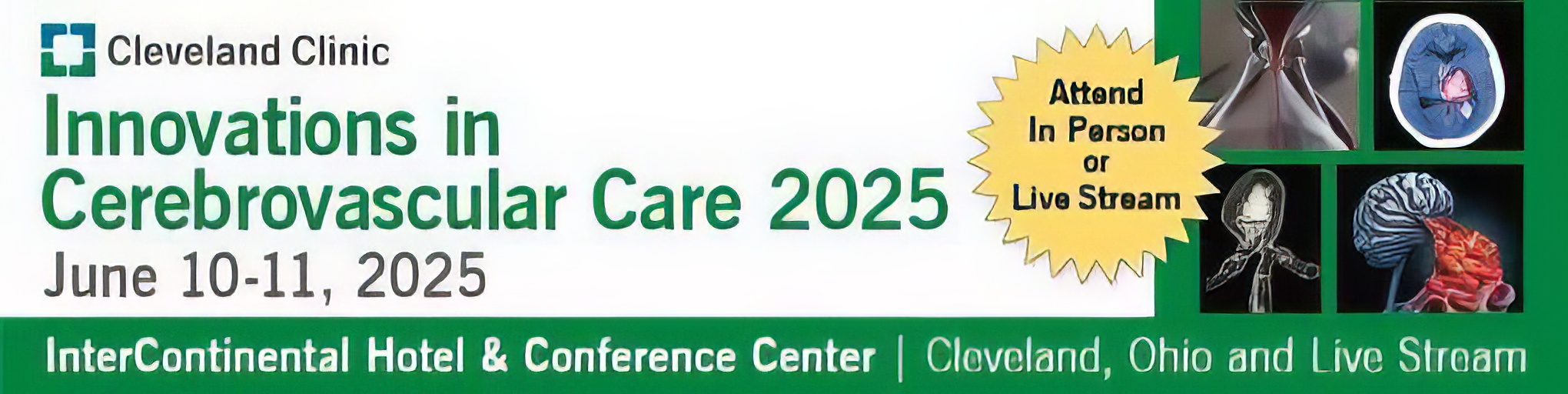 Cleveland Clinic Innovations in Cerebrovascular Care 2025 Cleveland Clinic Innovations in Cerebrovascular Care 2025