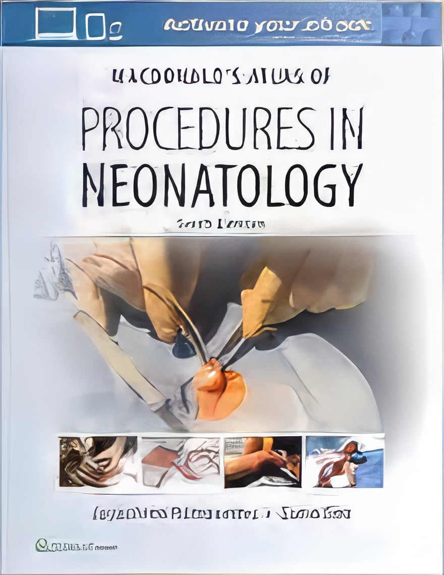 MacDonald’s Atlas of Procedures in Neonatology, 6th edition (Original PDF from Publisher) MacDonald’s Atlas of Procedures in Neonatology, 6th edition (Original PDF from Publisher)