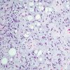 Cleveland Clinic Comprehensive and Immersive Soft Tissue Pathology 2025