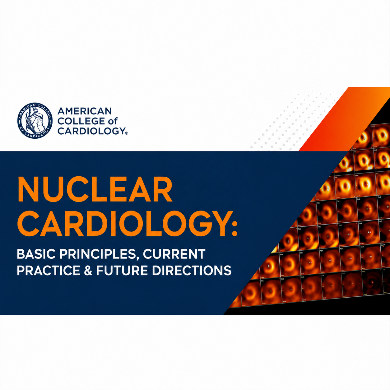 Nuclear Cardiology: Basic Principles, Current Practice, & Future Directions 2025 Nuclear Cardiology: Basic Principles, Current Practice, & Future Directions 2025