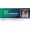 2025 Fetal Echocardiography: Normal and Abnormal Hearts – A Video CME Teaching Activity