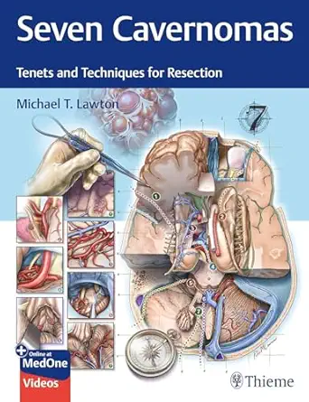 Seven Cavernomas: Tenets and Techniques for Resection (Videos Only) Seven Cavernomas: Tenets and Techniques for Resection (Videos Only)