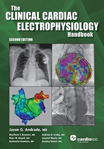 The Clinical Cardiac Electrophysiology Handbook, Second Edition (Original PDF from Publisher) The Clinical Cardiac Electrophysiology Handbook, Second Edition (Original PDF from Publisher)
