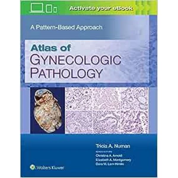 Atlas of Gynecologic Pathology: A Pattern-Based Approach (EPUB) Atlas of Gynecologic Pathology: A Pattern-Based Approach (EPUB)