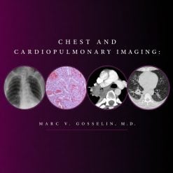 CMEScience Chest and Cardiopulmonary Imaging – Marc V. Gosselin, M.D (Videos + PDF)