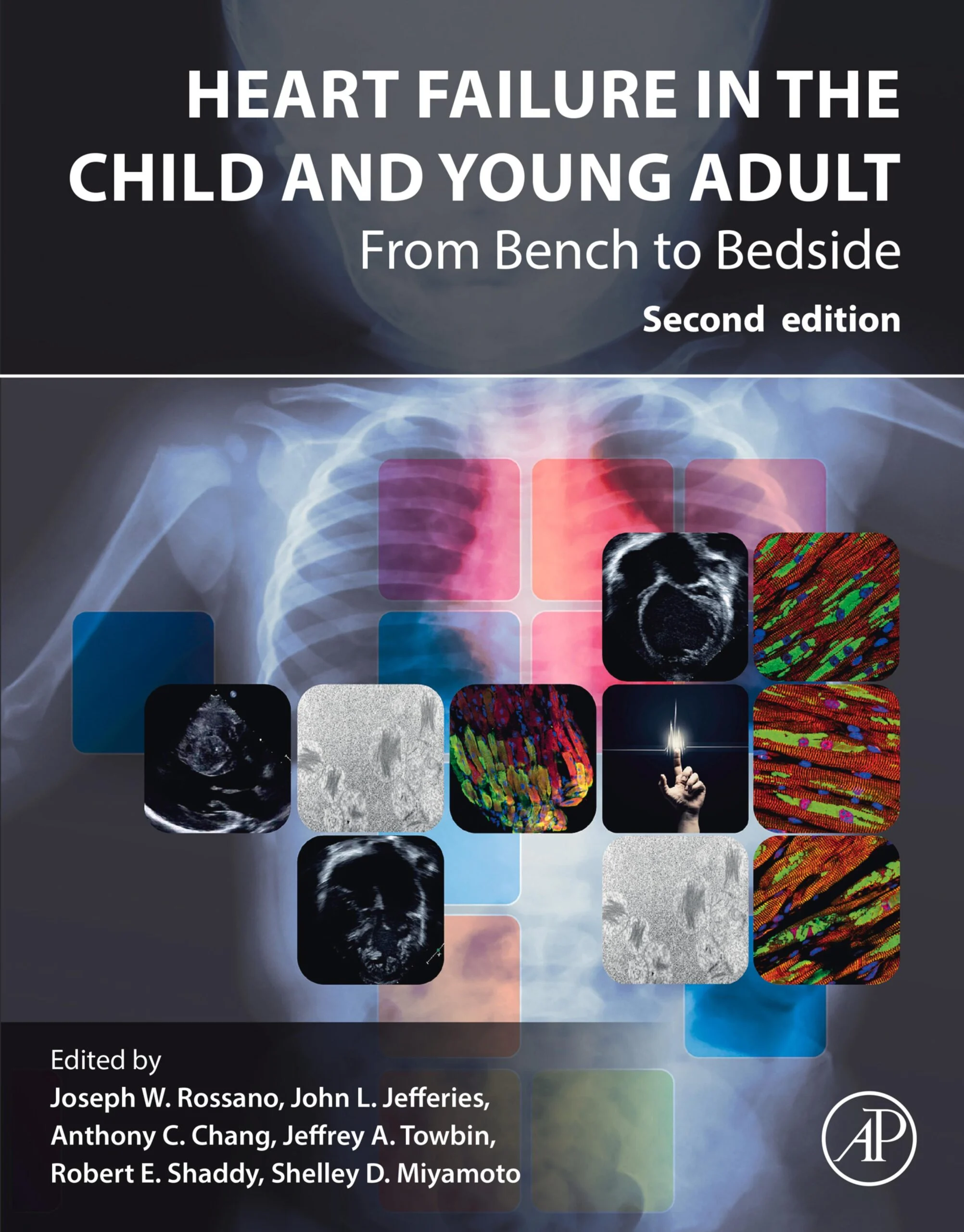 Heart Failure in the Child and Young Adult, 2nd Edition (Original PDF from Publisher) Heart Failure in the Child and Young Adult, 2nd Edition (Original PDF from Publisher)