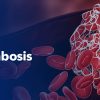 Memorial Sloan Kettering Cancer Center State-of-the-Art in Benign Hematology, Hemostasis, and Thrombosis 2025 Memorial Sloan Kettering Cancer Center State-of-the-Art in Benign Hematology, Hemostasis, and Thrombosis 2025