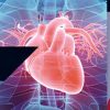 Penn Medicine UPenn HFpEF Symposium 2025