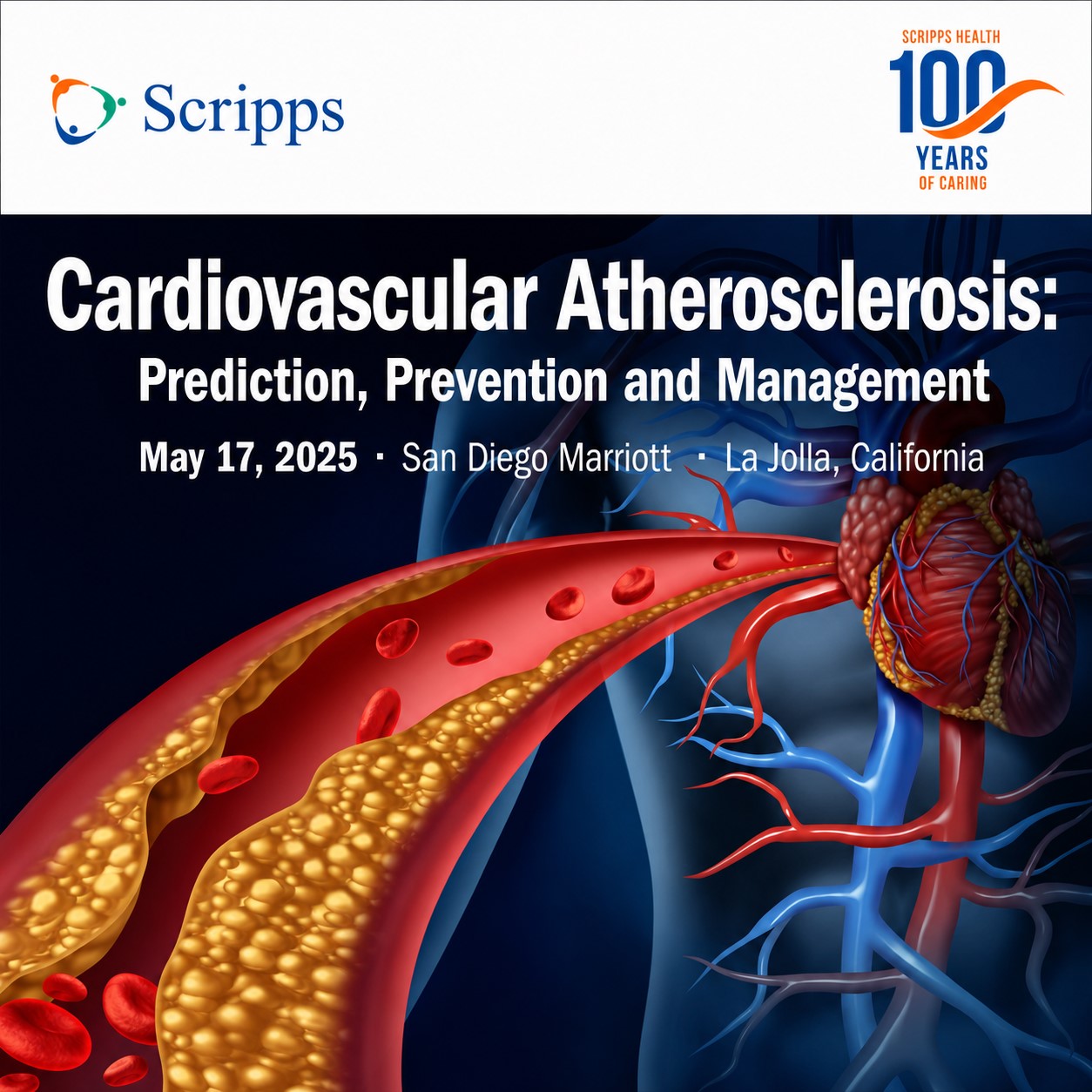 Scripps Cardiovascular Atherosclerosis Prediction, Prevention and Management 2025 Scripps Cardiovascular Atherosclerosis Prediction, Prevention and Management 2025