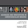 Advances and Innovations in Cardiovascular Imaging, An Issue of Radiologic Clinics of North America (True PDF from Publisher) Advances and Innovations in Cardiovascular Imaging, An Issue of Radiologic Clinics of North America (True PDF from Publisher)