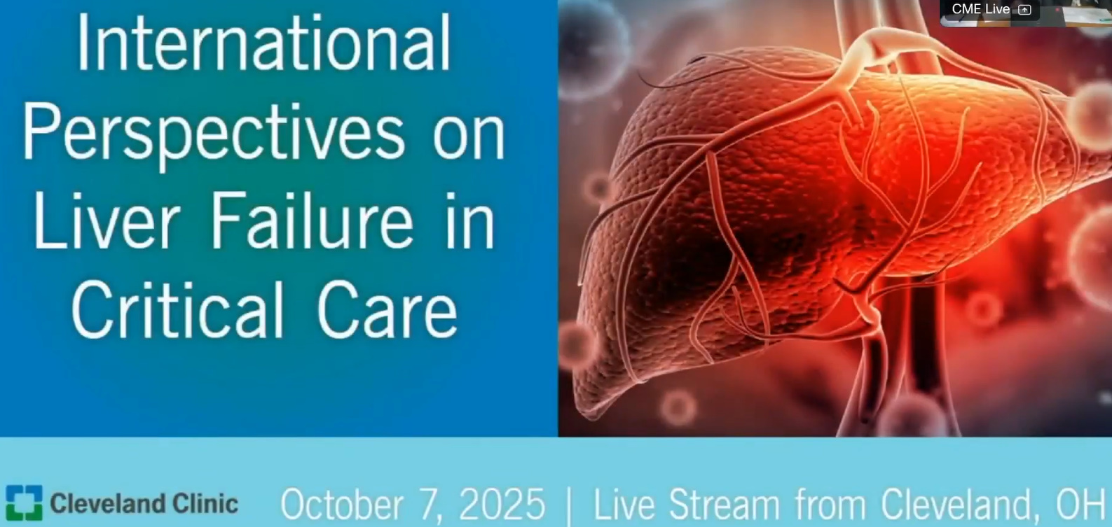 Cleveland Clinic International Perspectives on Liver Failure in Critical Care 2025 Cleveland Clinic International Perspectives on Liver Failure in Critical Care 2025