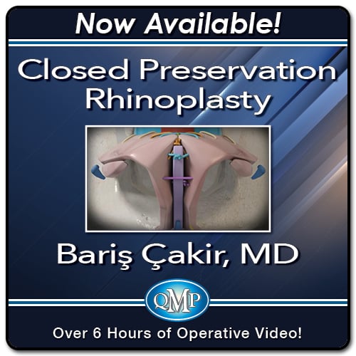 Closed Preservation Rhinoplasty 2023 Closed Preservation Rhinoplasty 2023