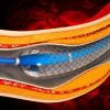 Comprehensive Review and Update of What’s New in Vascular and Endovascular Surgery Comprehensive Review and Update of What’s New in Vascular and Endovascular Surgery