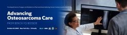 Memorial Sloan Kettering Cancer Center Advancing Osteosarcoma Care From Bench to Bedside 2025
